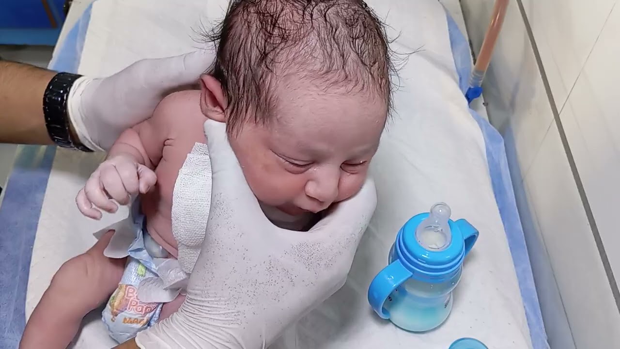 New born baby feeding techniques and mangment 