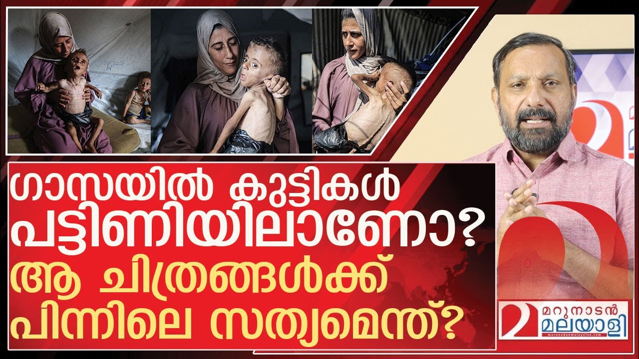 ഗാസയിൽ പട്ടിണിയാണോ? ആ ചിത്രങ്ങൾ വ്യാജമാണോ? l Mohammed Zakaria al Mutawaq, gaza