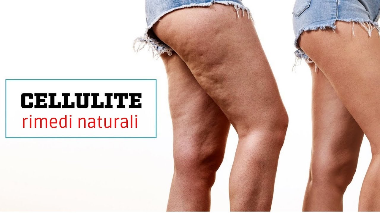 Elimina la CELLULITE in 5 passi