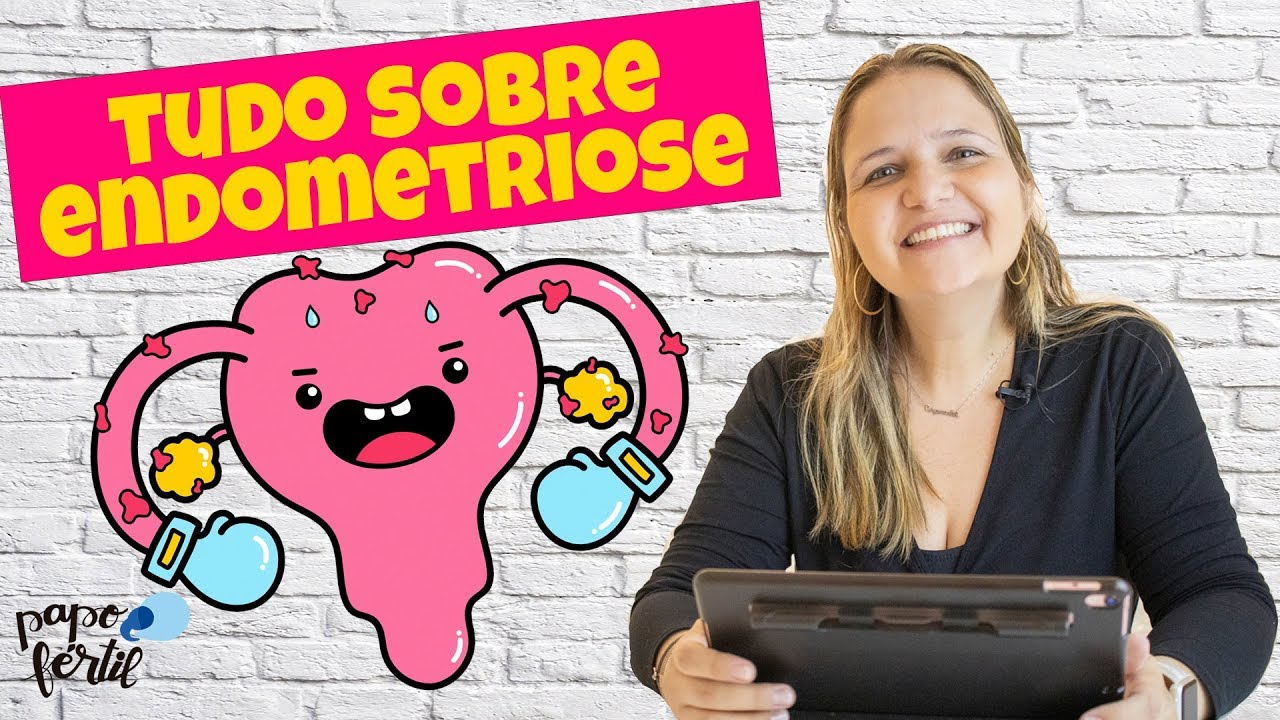 TUDO sobre Endometriose: O que é, Causas, Sintomas, Tipos, Diagnóstico e Tratamentos