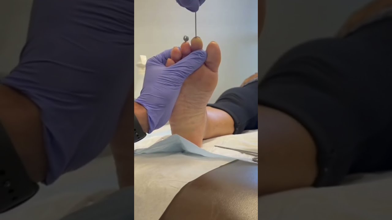 Необычное удаление штифтов: вы не поверите их длине!