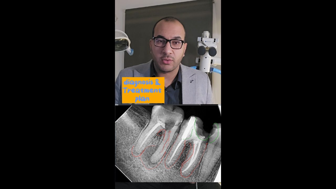 اجابة السؤال رقم #1 للحالة اللي نزلت امس عن التشخيص و خطة العلاج 