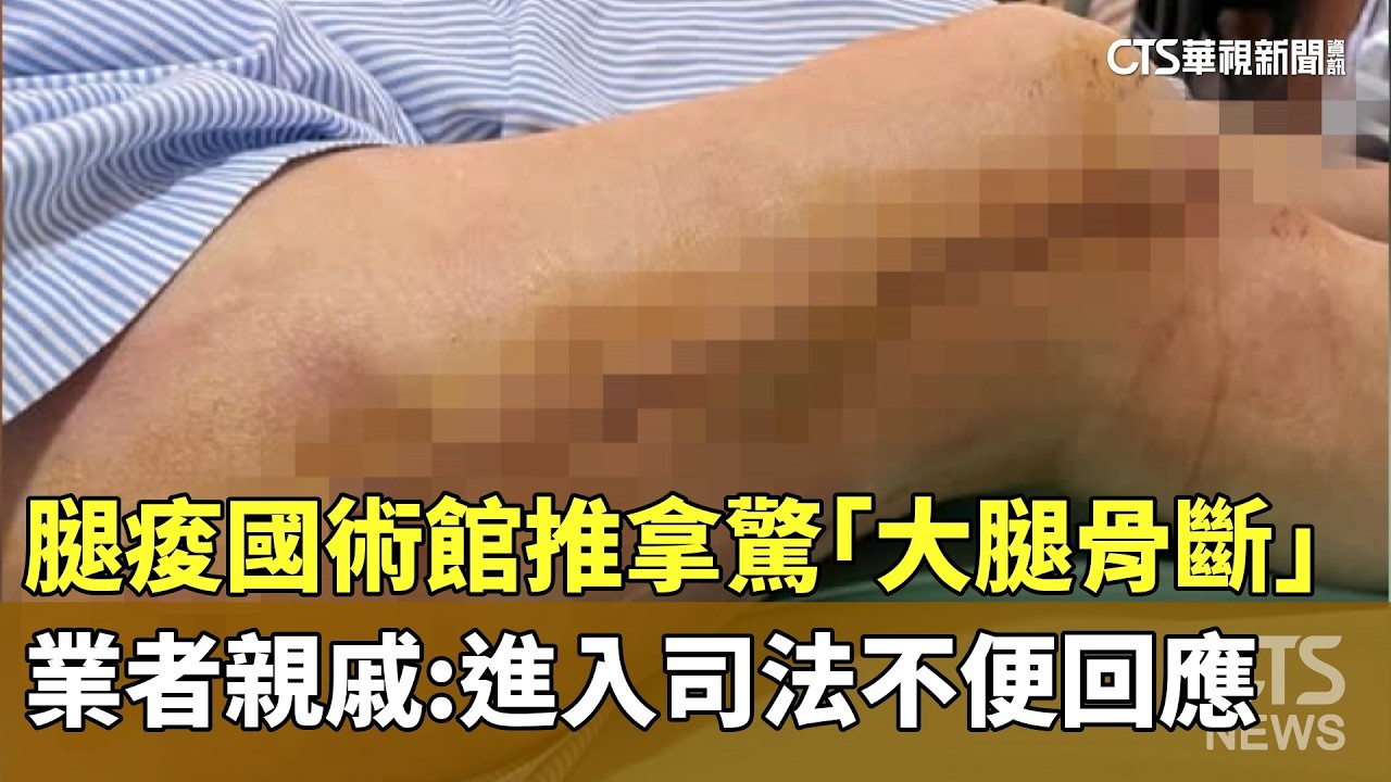 腿痠國術館推拿驚「大腿骨斷」　業者親戚：進入司法不便回應｜華視新聞 20260318 @華視新聞 CH52