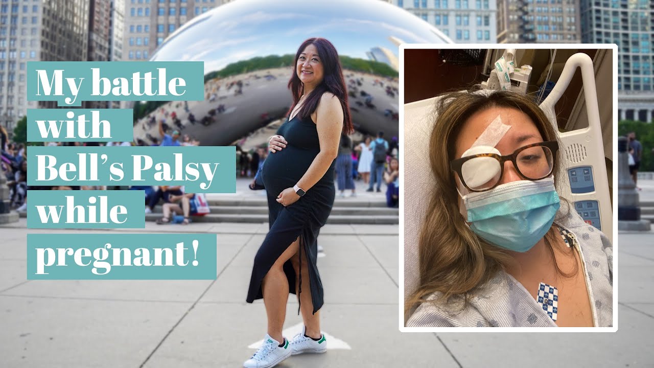My Sudden Bell's Palsy Diagnosis while Pregnant at 40 - Chef Julie Yoon