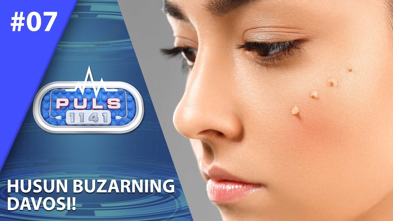 Puls 1141 7-son Husun buzarning davosi! (18.07.2019)