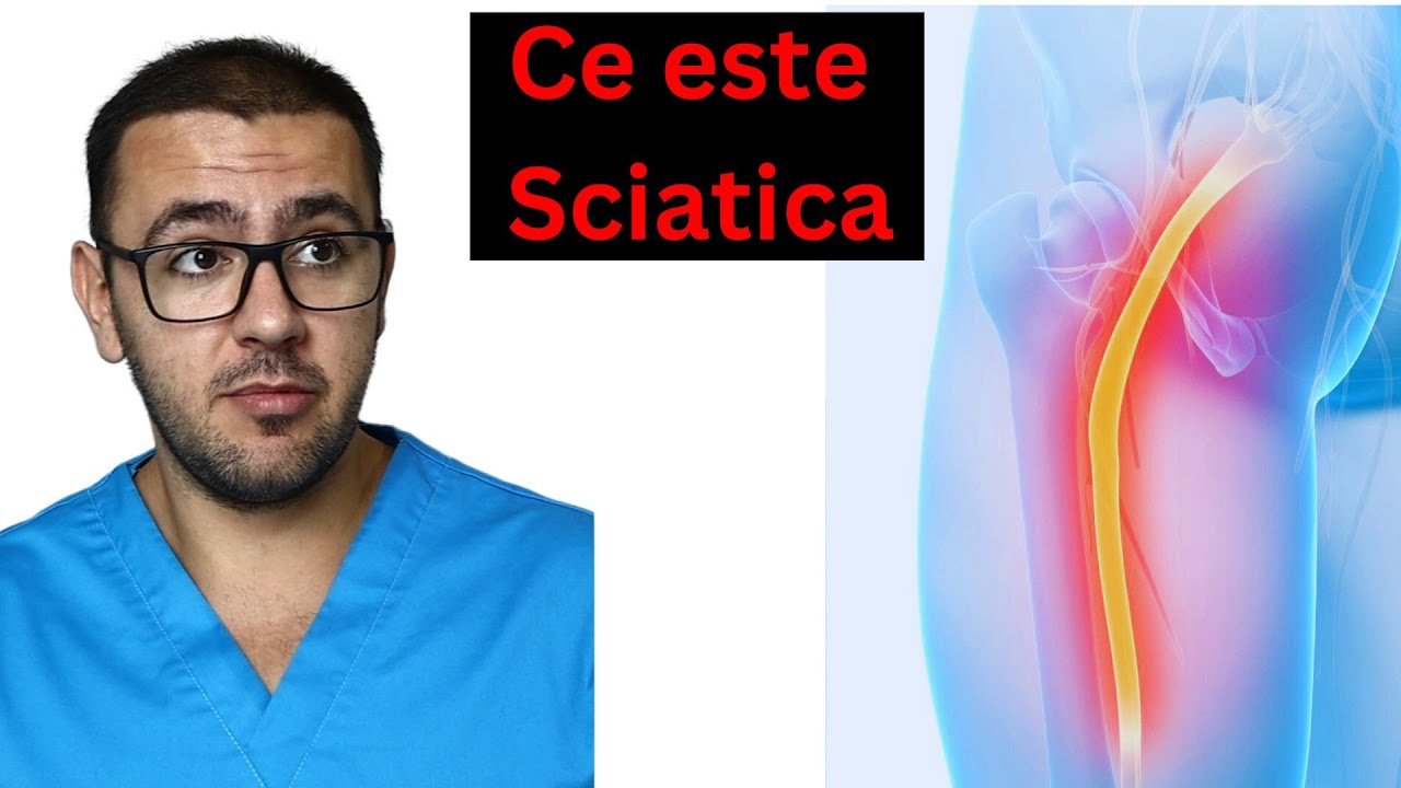 Ce este durerea sciatică #kinetoterapie
