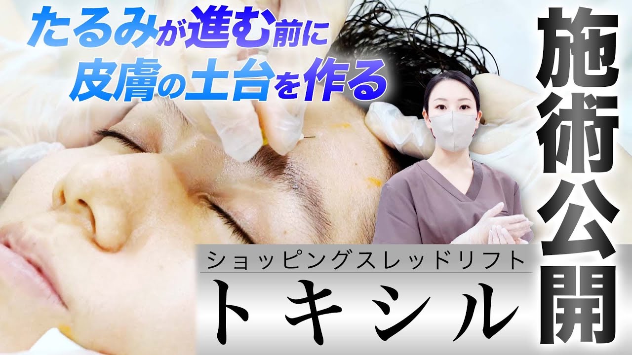 【2024年の新治療】西川医師がトキシルの施術を行いましたのでお見せします。