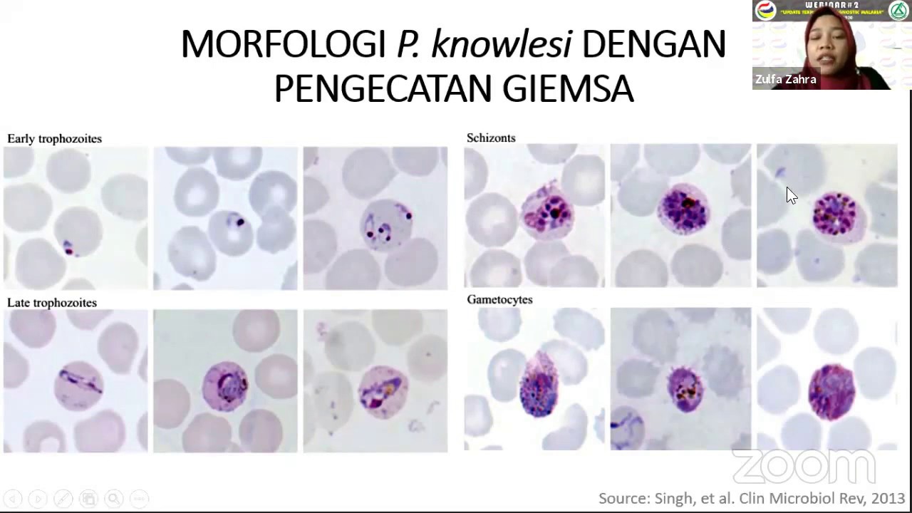 Plasmodium Knowlesi | Webinar ITKES WHS