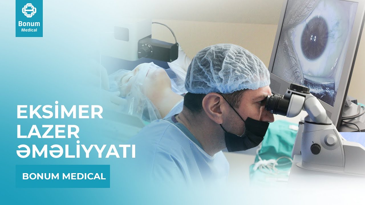Eksimer Lazer Əməliyyatı - Oftalmoloq Cərrah Rəfədar Xəlilov #bonummedical