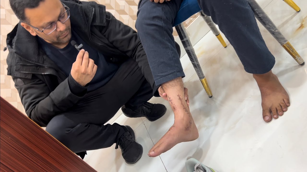 Foot drop after surgery Recovery in a patient with Polyneuropathy( foot drop both feet)