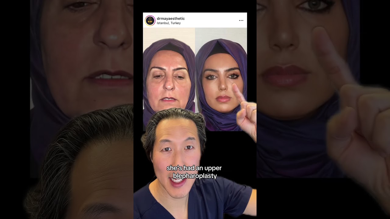 Should You Have Plastic Surgery in Turkey?