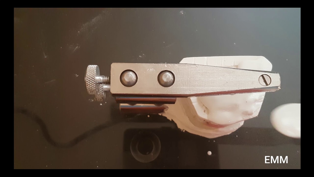BIMLER A1 MONTAJE