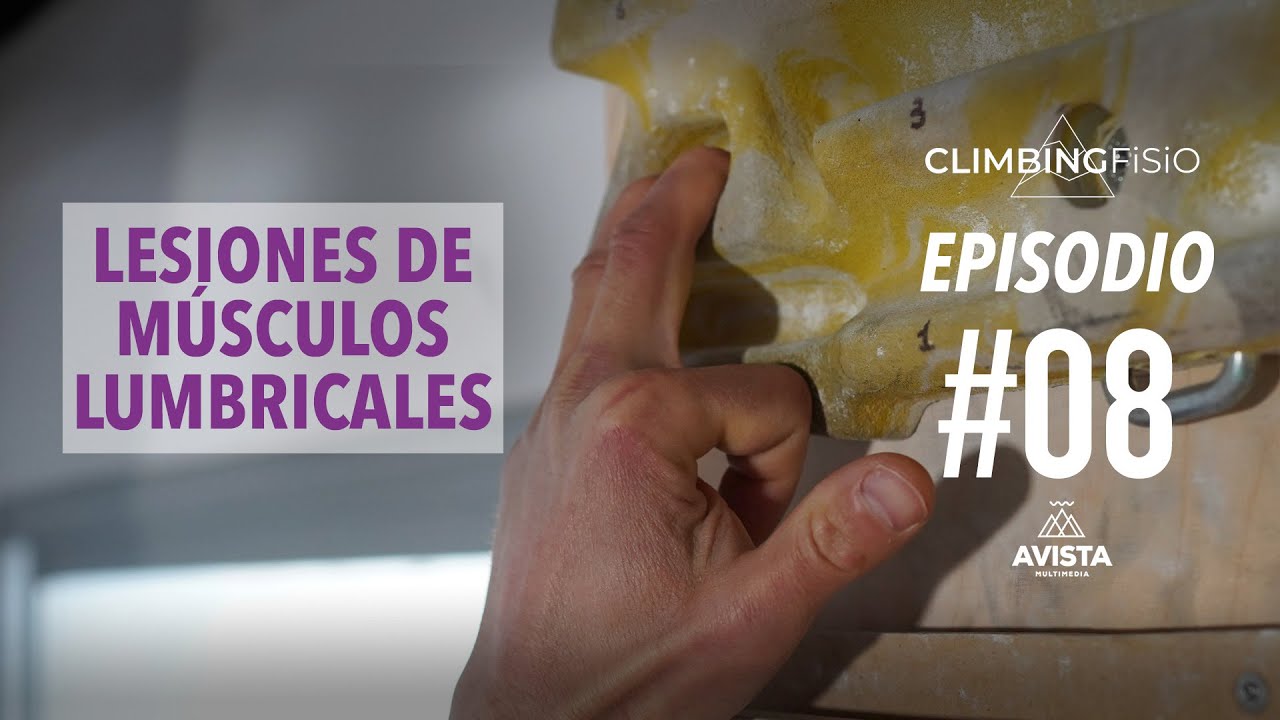 CLIMBINGFISIO EP 08 LESIONES DE LUMBRICALES