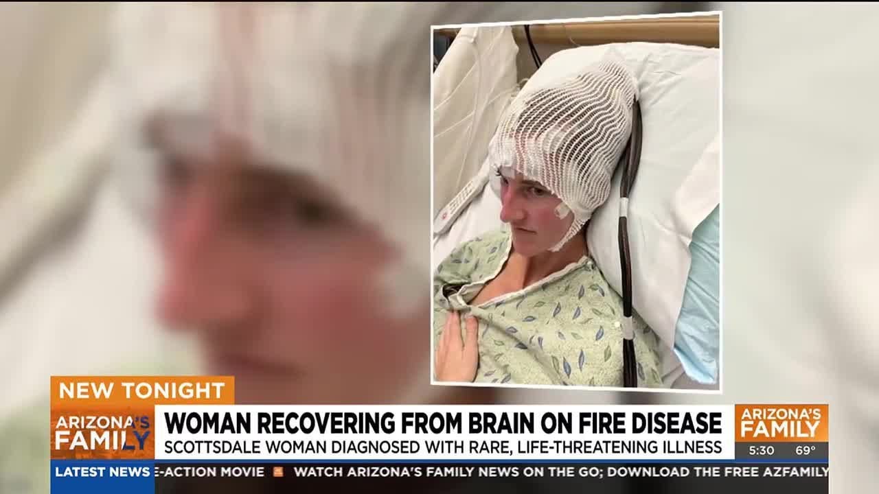 Scottsdale woman recovering from 