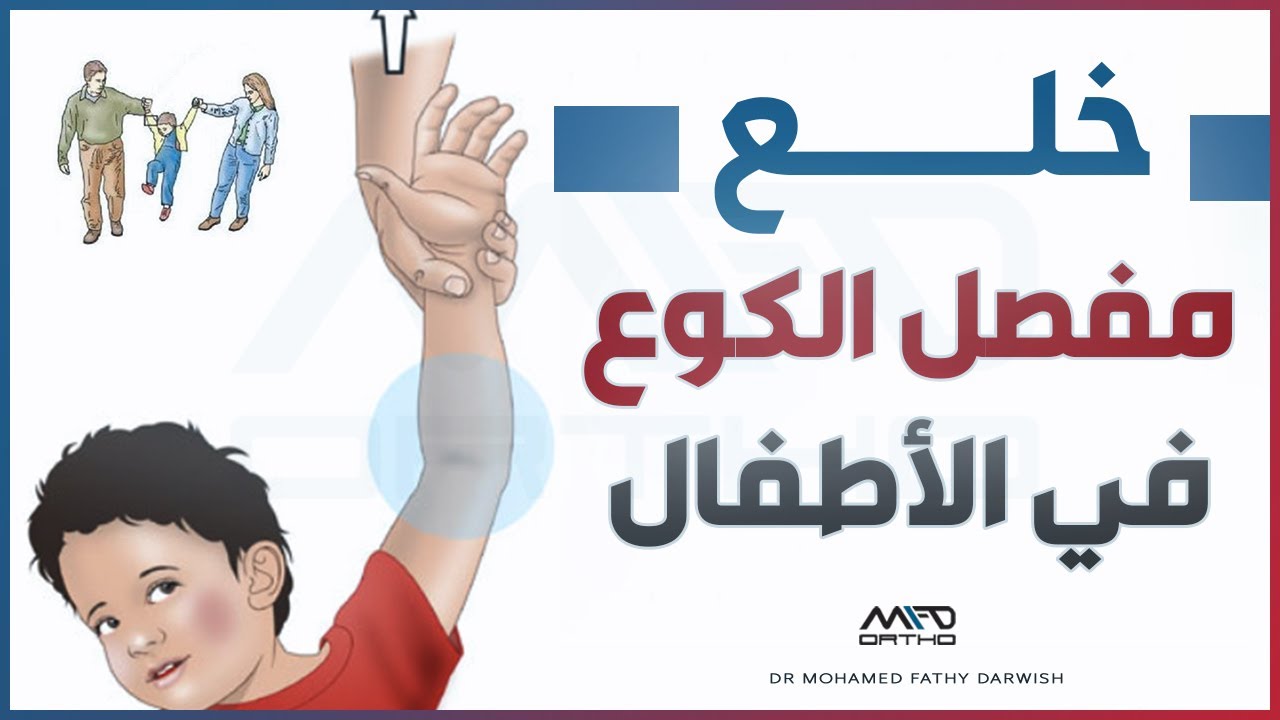خلع مفصل الكوع في الأطفال - كيفية تفاديه | دكتور محمد فتحي درويش