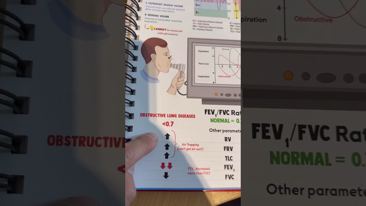 Спирометрия объясняется в 60-х годах 🔃💨#medschool #medicalschool #usmle #usmlestep1 #usmlestep2
