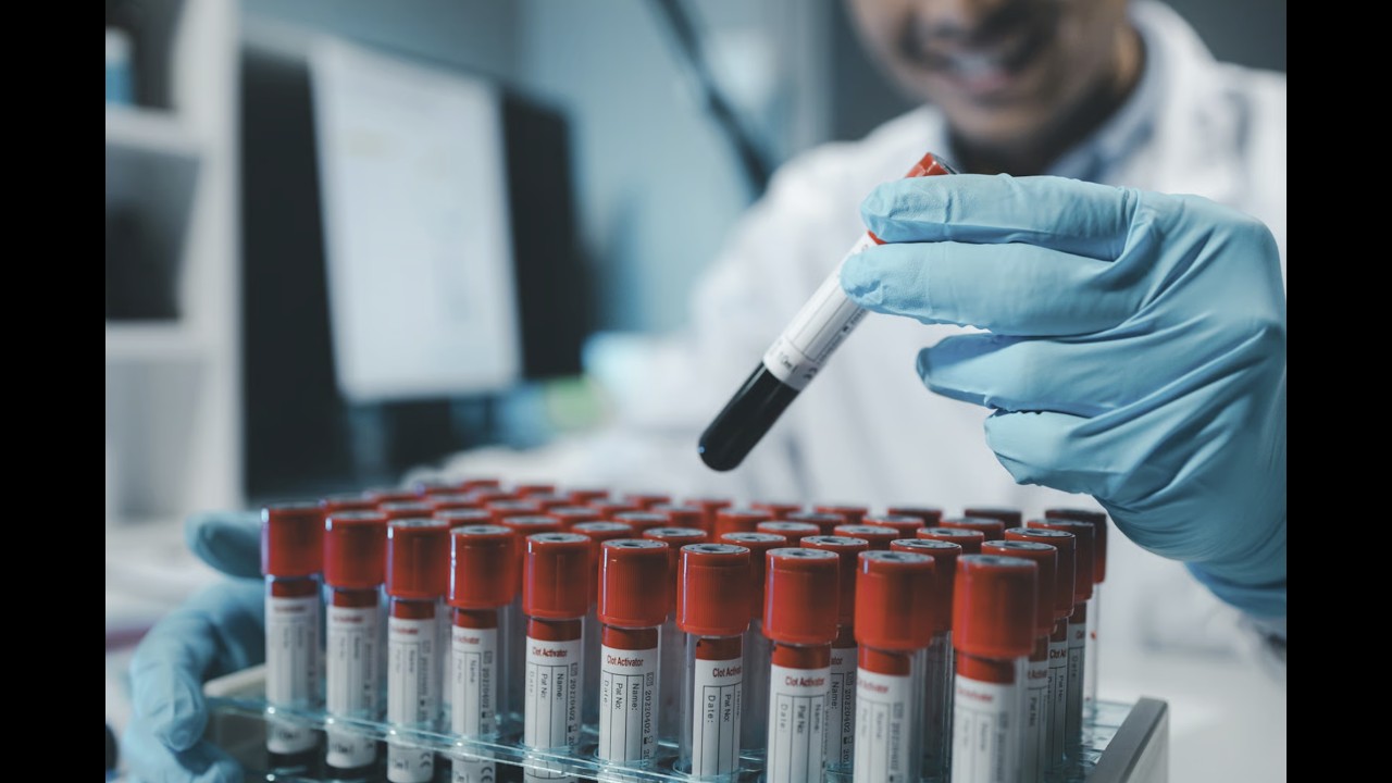 Rhythm Biosciences (ASX:RHY) is now cleared to offer its ColoSTAT test to patients in Australia!