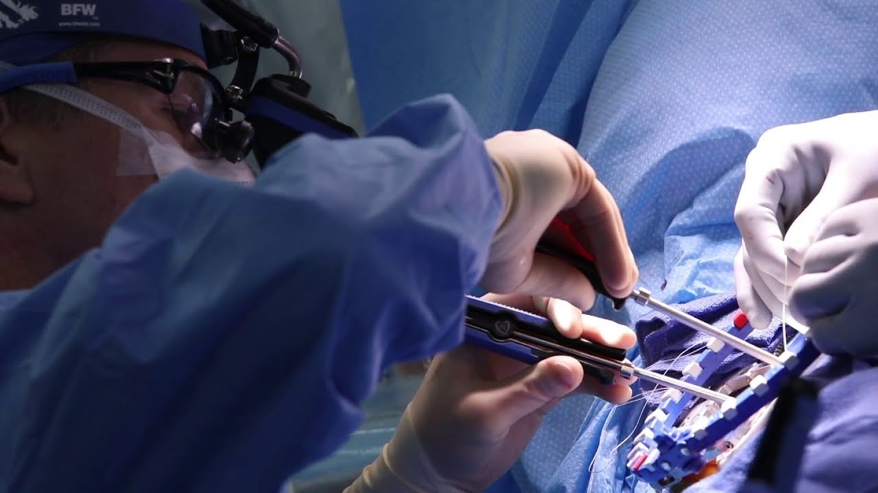 'Miami Method' is less invasive option for patients with heart issues