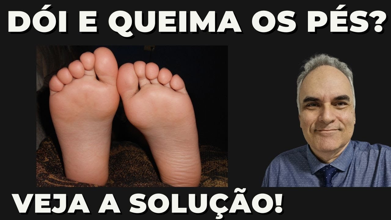 Neuropatia tá incomodando? 6 suplementos para ajudar!