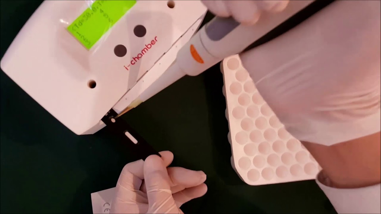 HbA1c Mejorada Analizador IChroma, KontroLab. DESEGO
