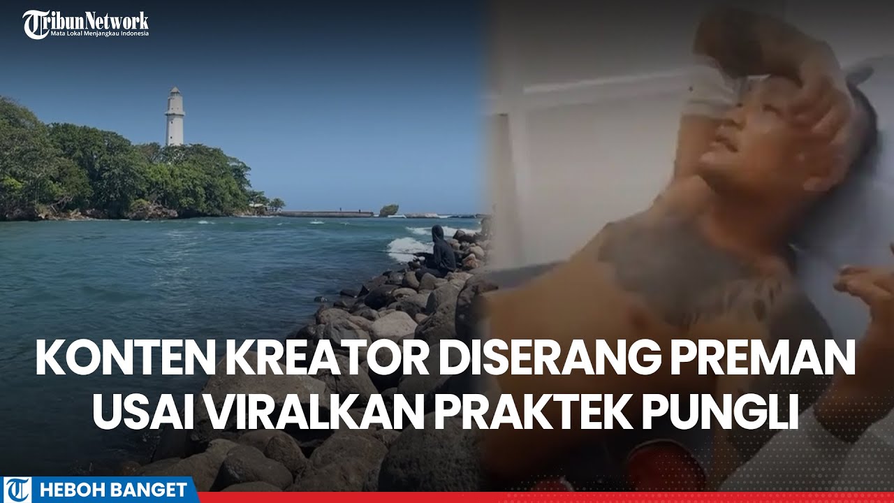 Viralkan Praktik Pungli di Santolo Garut, Seorang Konten Kreator Jadi Korban Pembacokan Preman