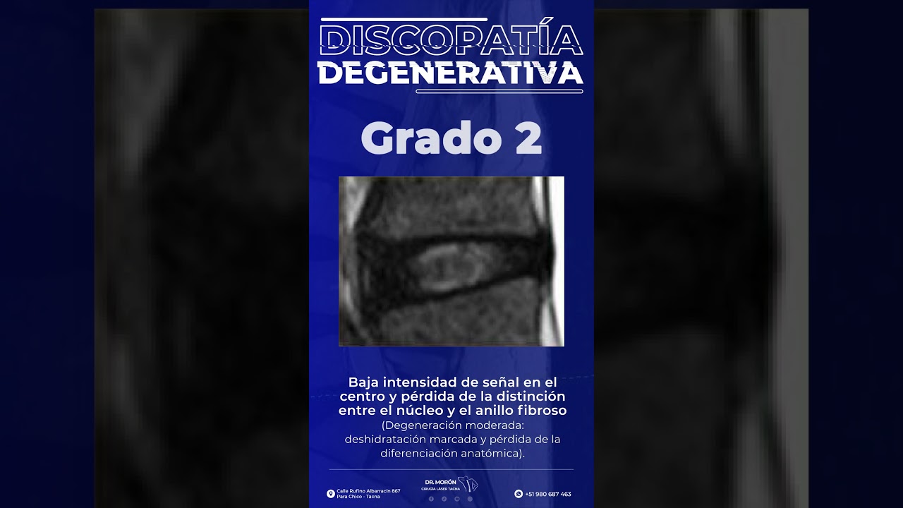 Tu columna tambi&eacute;n envejece: descubre en qu&eacute; grado est&aacute;s