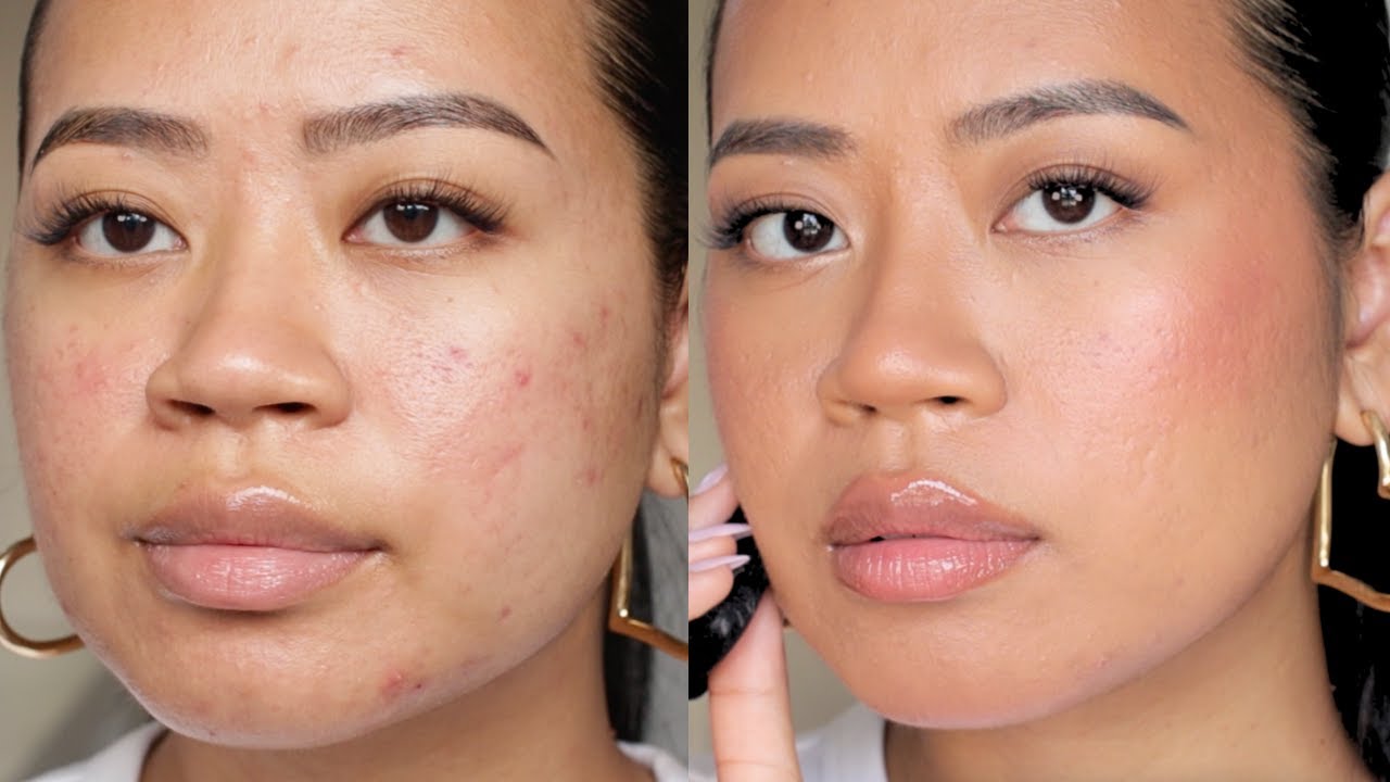 Makeup for Acne Prone, Textured Skin, Oily Skin