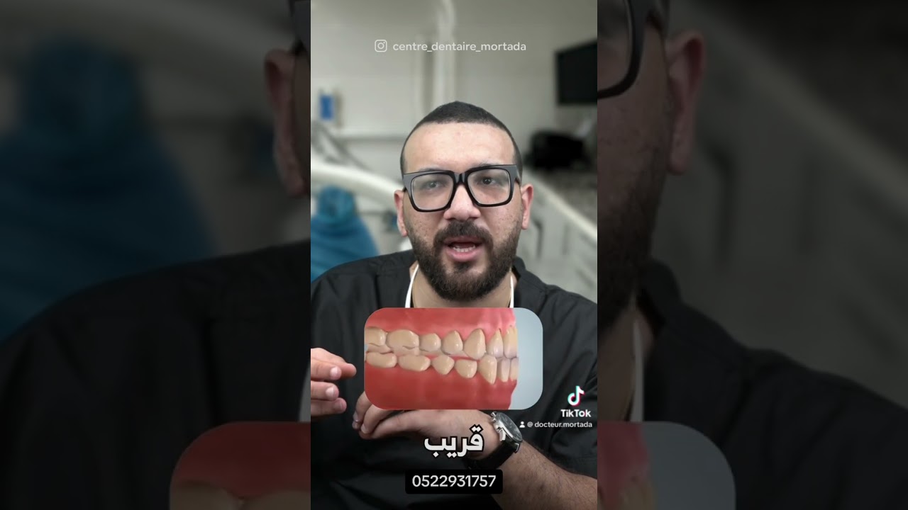 #dentist #choftv #dentistry #chouf #shortvideo #orthodontist #chouftvlive #veneers