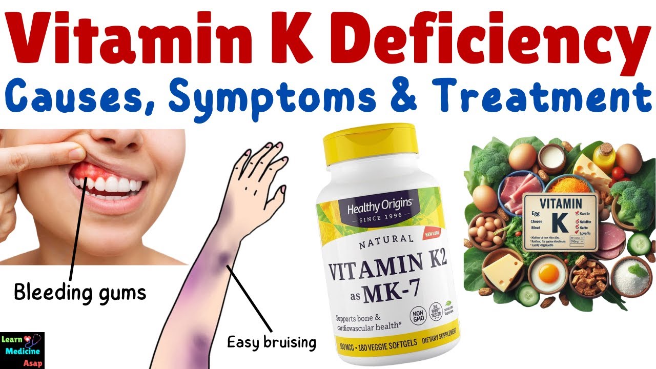 Vitamin K Deficiency &ndash; Causes, Symptoms, Diagnosis, Treatment & Prevention
