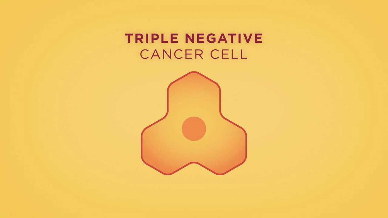 Beyond The Shock - Chapter 5 -  Types & Stages - Triple Negative Breast Cancer