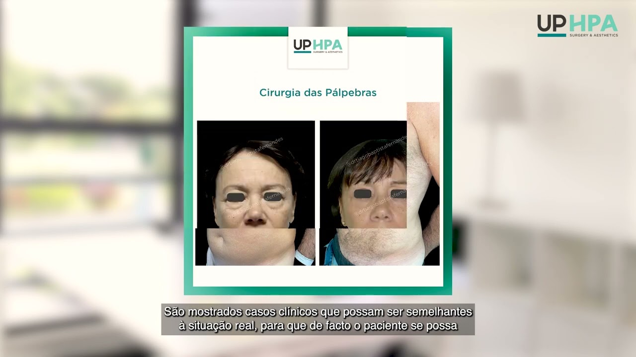 Dr. Tiago Baptista Fernandes UP HPA