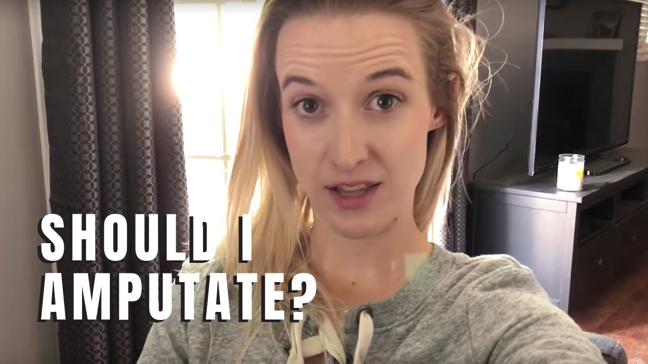 Why do I have to consider amputation?
