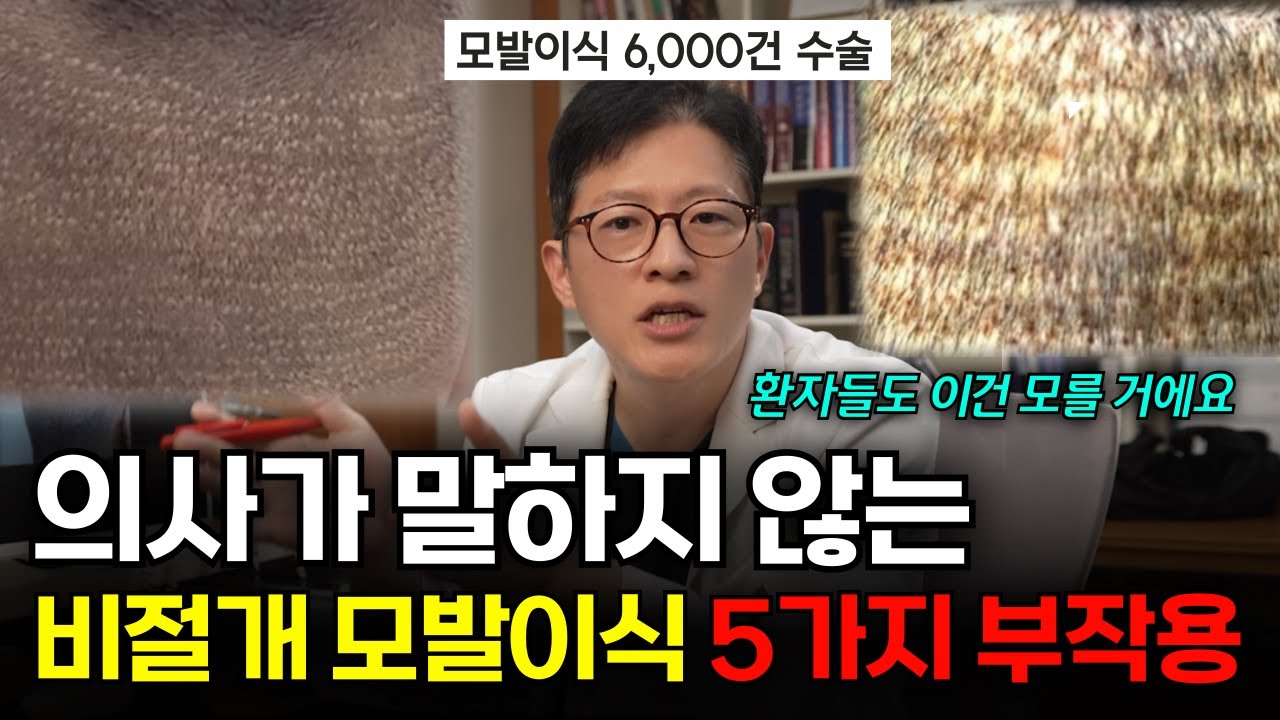 비절개 모발이식 부작용 5가지, 수술받기 전에 의사가 알려주지 않는 진실