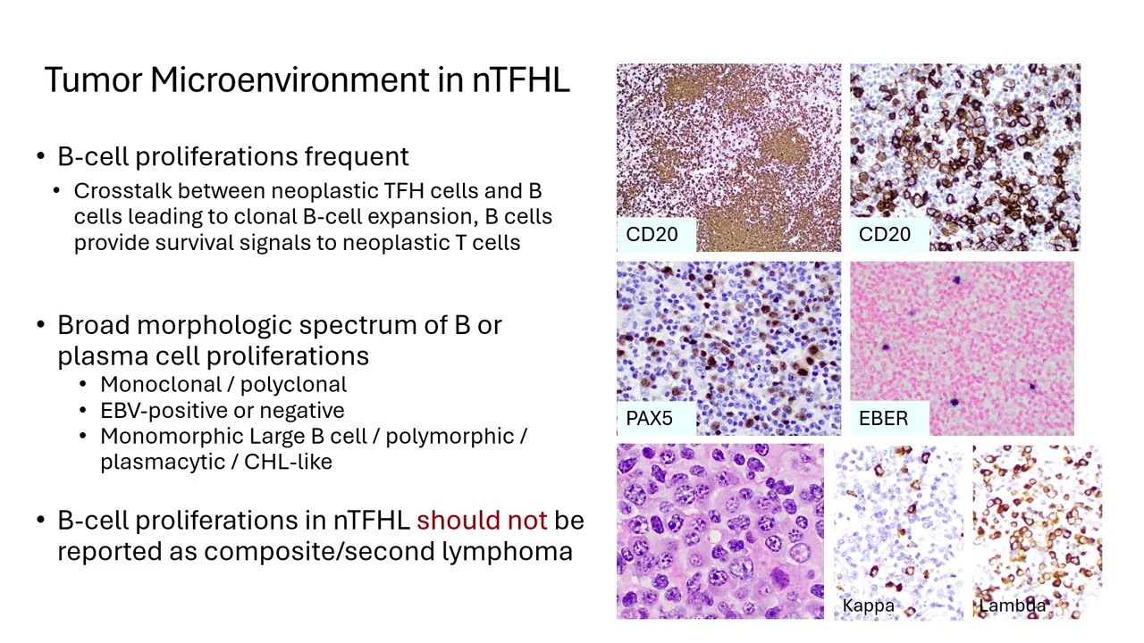 AP-IAP 2025, Hematopathology, Siok Bian Ng