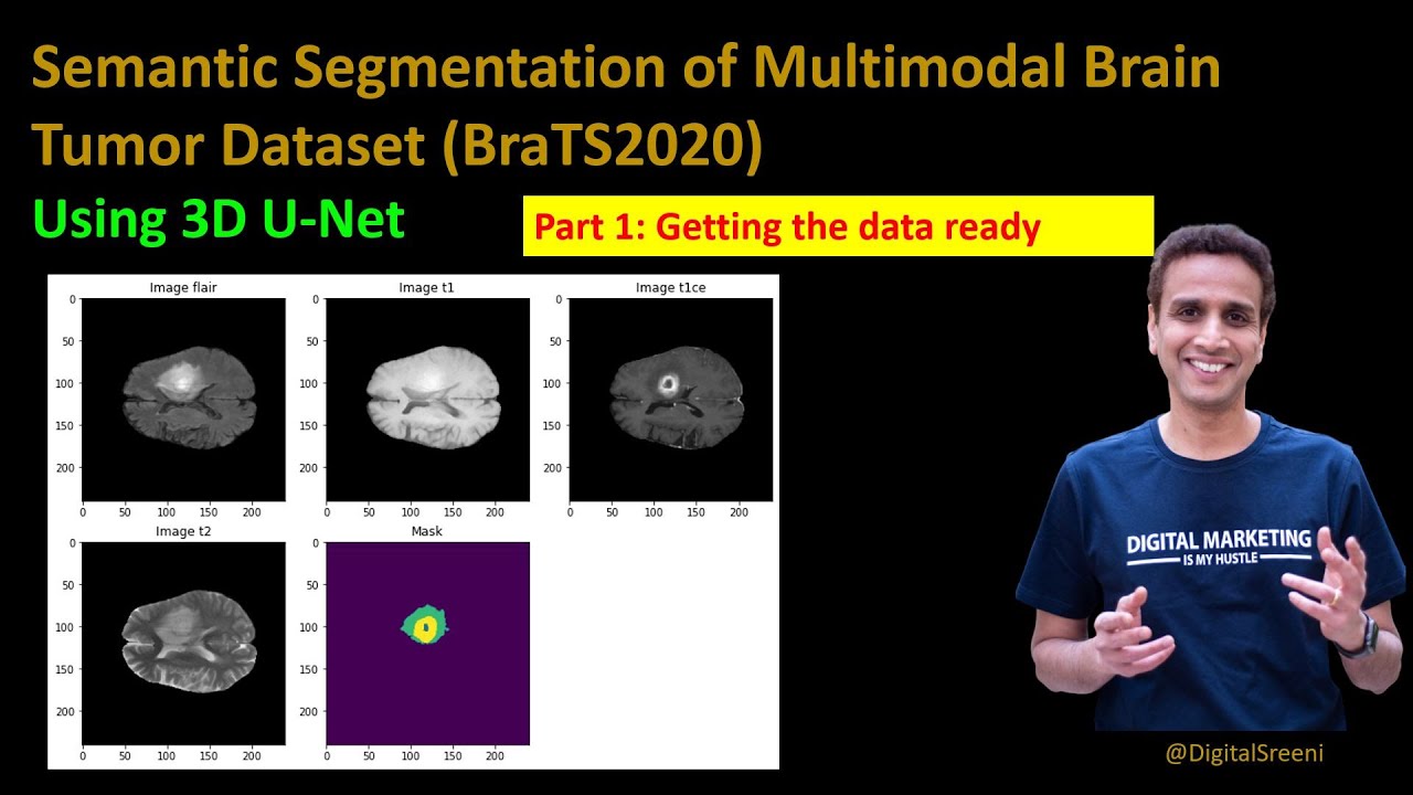 232 - Semantic Segmentation of BraTS2020 - Part 1 - Getting the data ready