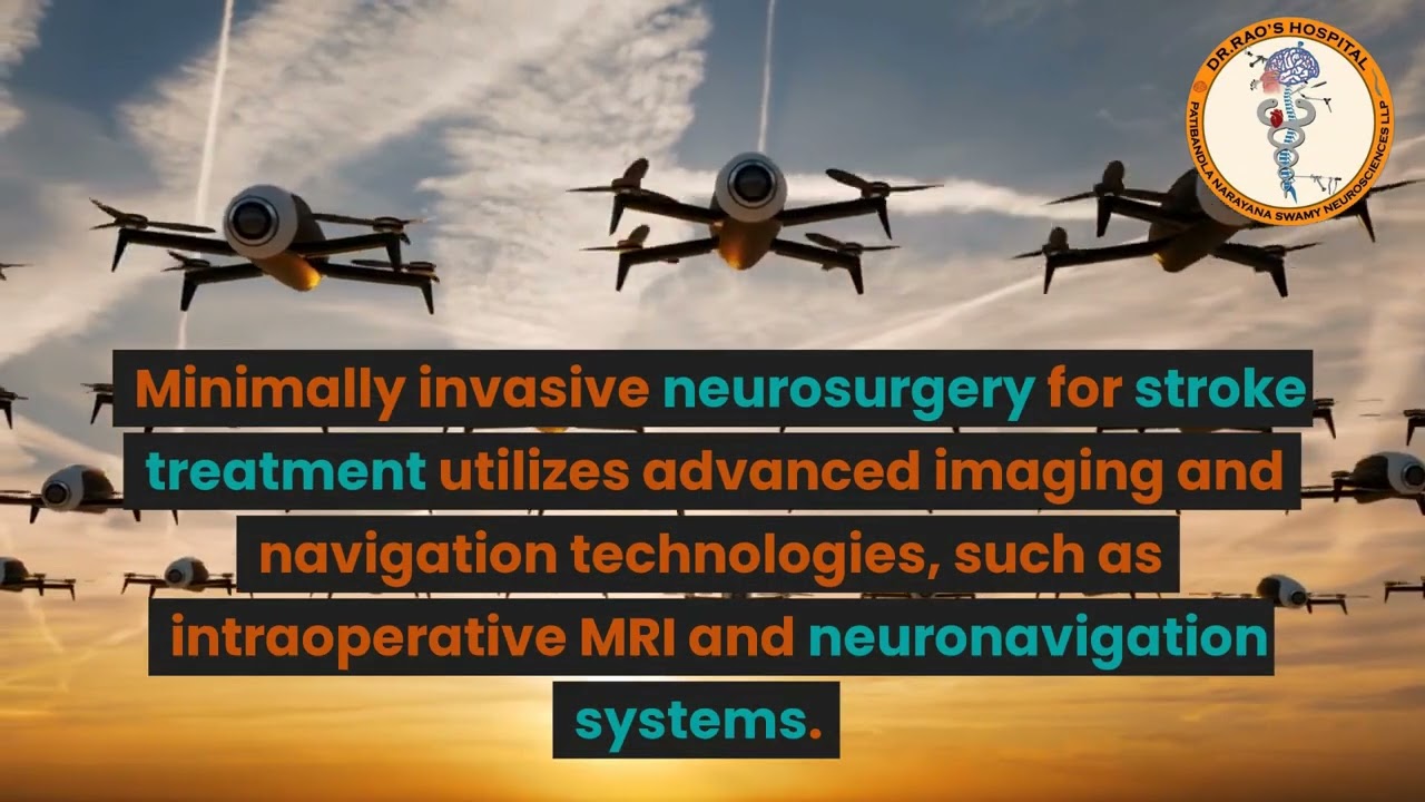 How Minimally Invasive Neurosurgery is Revolutionizing Treatment for Stroke Patients