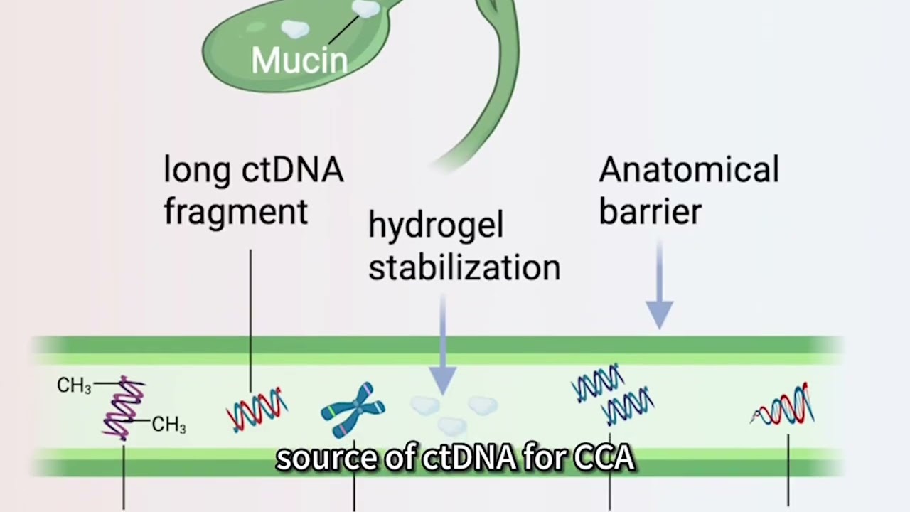 Circulating tumor DNA in cholangiocarcinoma – Video abstract [574678]