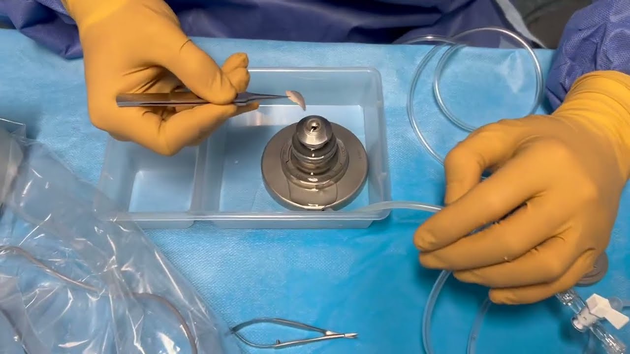 DSAEK Graft Preparation