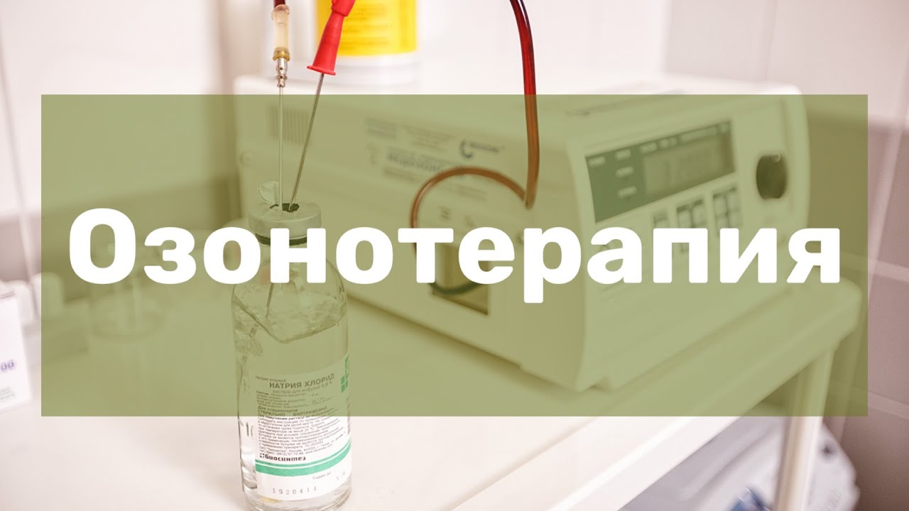 Озонотерапия