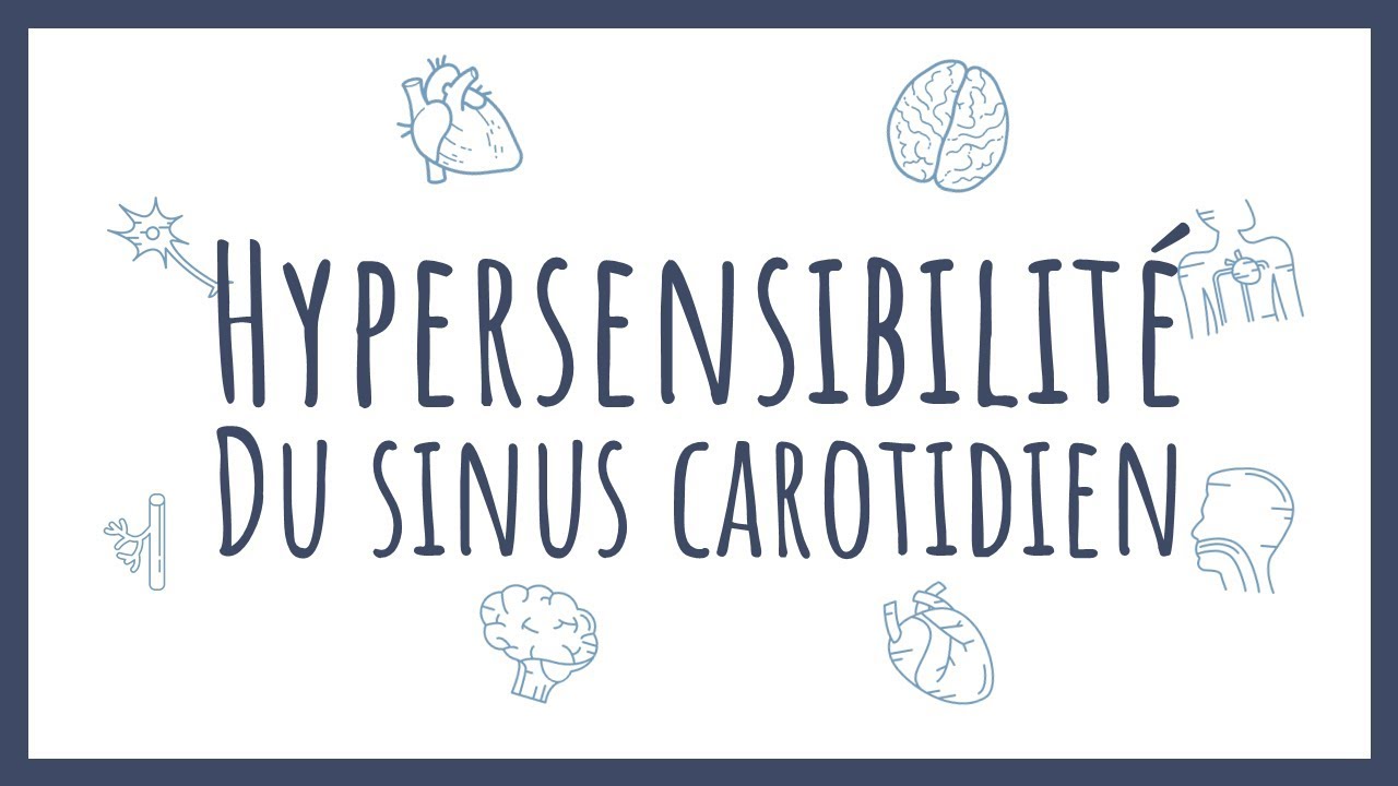 Sémiologie Cardiaque - Hypersensibilité du sinus carotidien