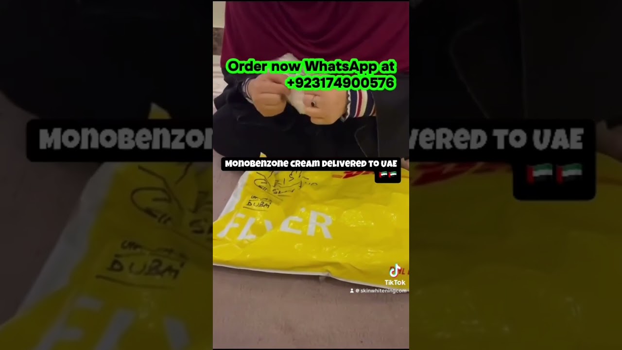 Vitiligo treatment remove remaining pigment from skin makes whole body white