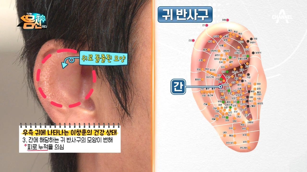 (귀에 나타나는 건강 적신호) 귀를 통해 본 이창훈의 전신 건강 상태는?! | 나는 몸신이다 299 회
