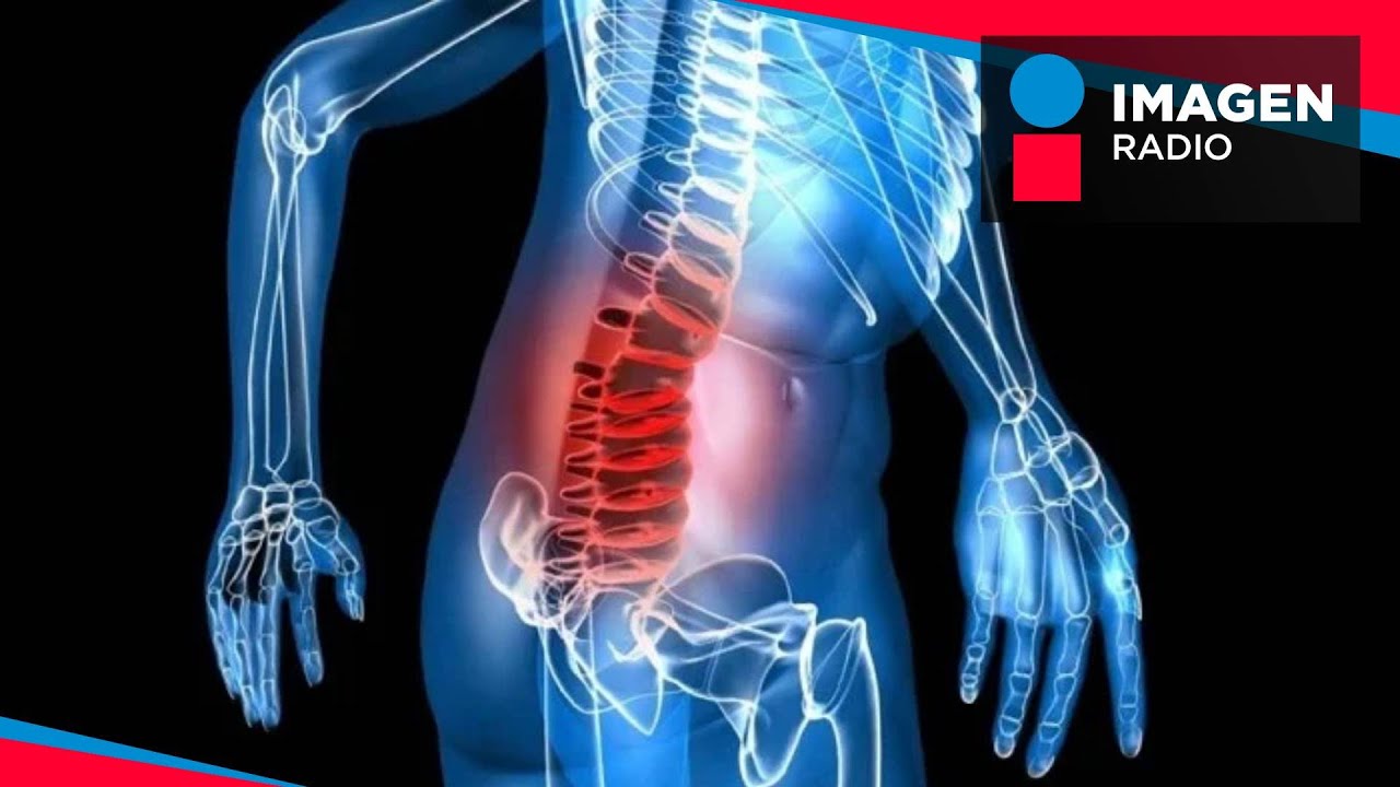 ¿Qué es y qué causa el mieloma múltiple?