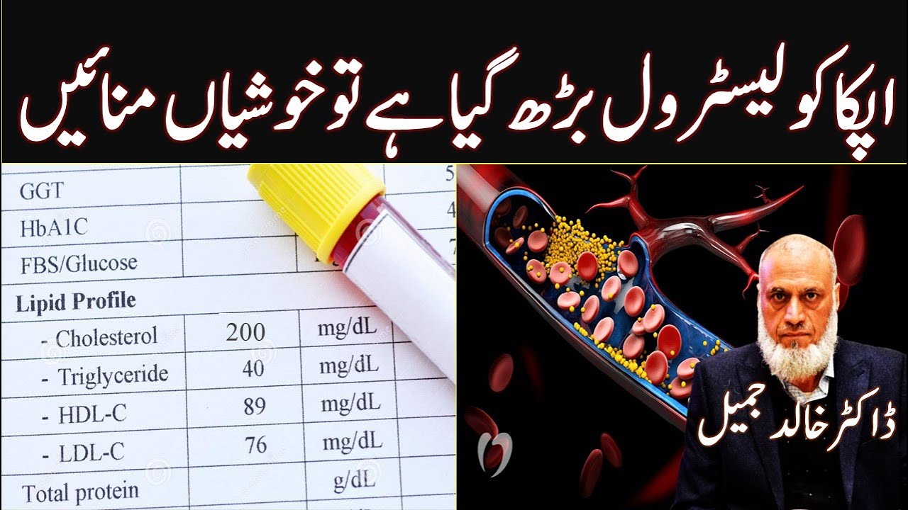 Celebrate High Cholesterol + LDL | Lecture 161