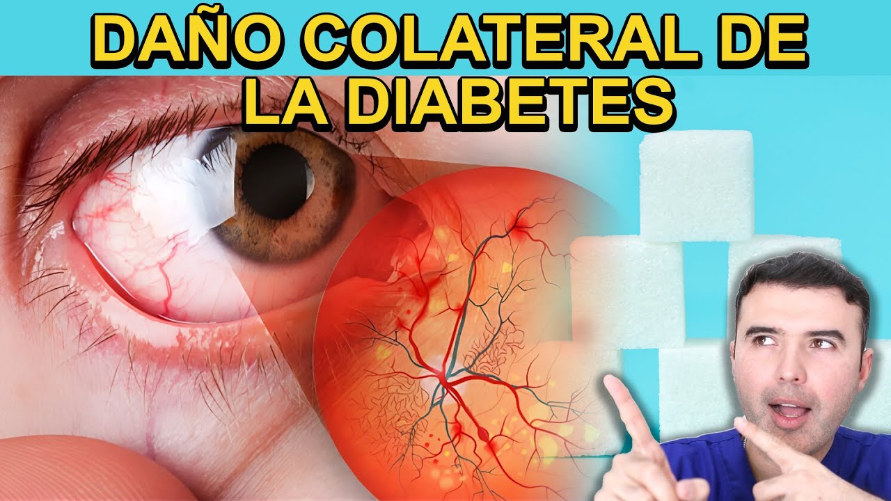 ¿Vista Nublada y Mucha Sed? ¡Cuidado con la Diabetes!