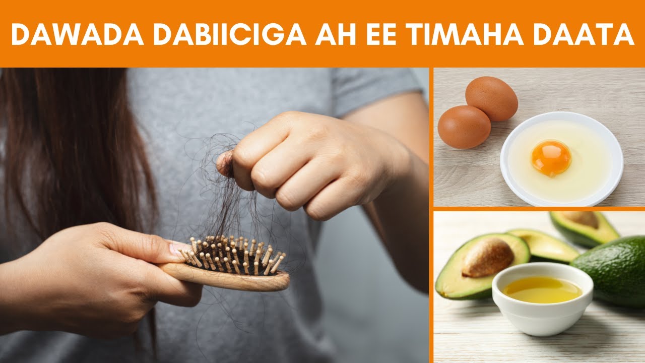 Dawooyinka Dabiiciga Ah Ee U Fiican Timaha Daata