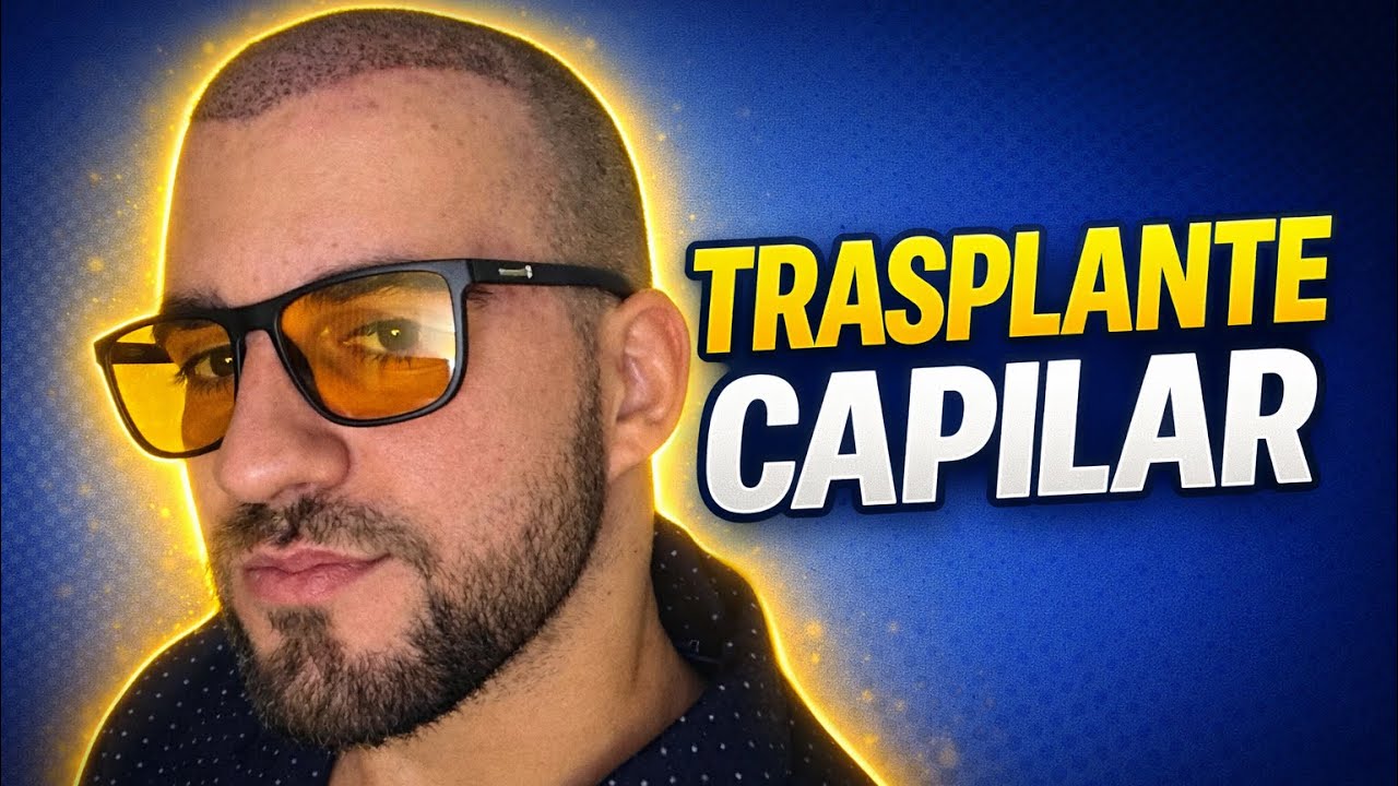 Mi trasplante capilar: nadie me avisó de ESTO