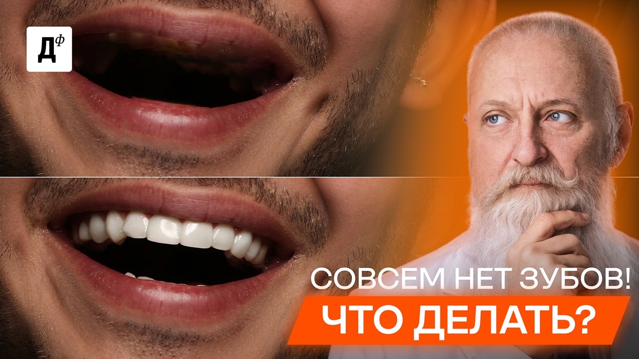 НЕТ зубов? НЕ СТАВЬТЕ импланты, пока не посмотрите это видео!
