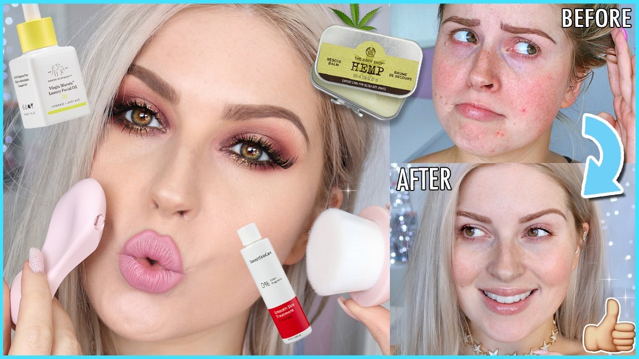 Easy Skincare Routine! 💕 How To Clear ACNE & Get FLAWLESS Skin!