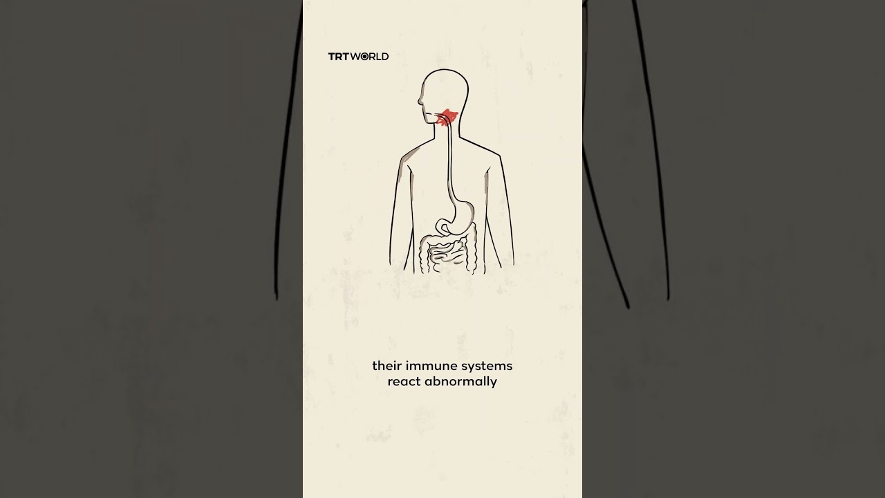 What is celiac disease, and how does gluten affect the body? | Scienticious - Episode 10